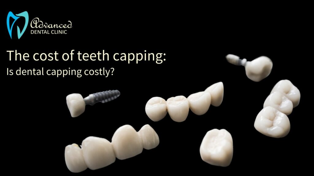 Cost of Teeth Capping: The Dental Caps Cost to Value Relation