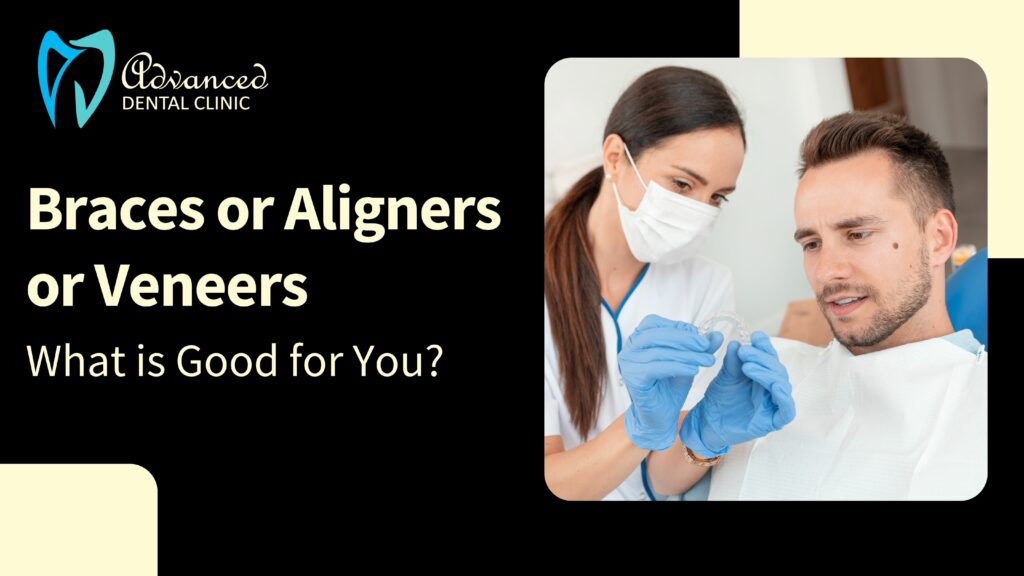 Braces or Aligners or Veneers: What is Good for You?