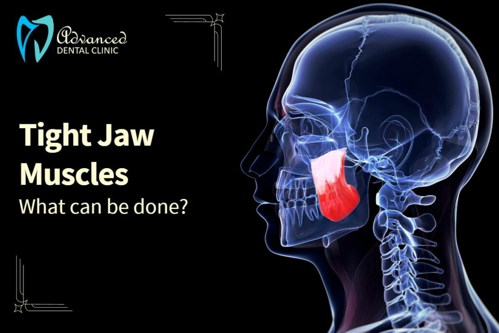 What can be done for Tight jaw muscles?