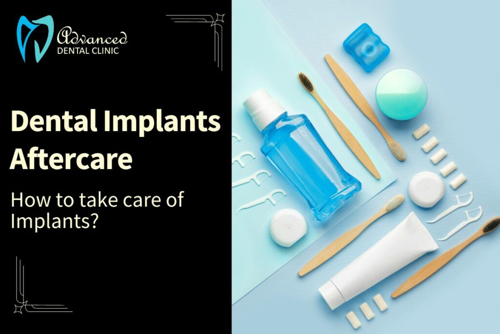 How to take care of implants?