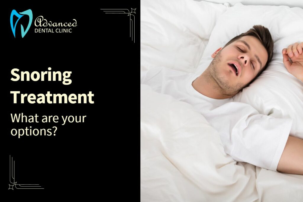 Snoring Treatment Options