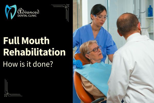 How Full Mouth Rehabilitation is Done?