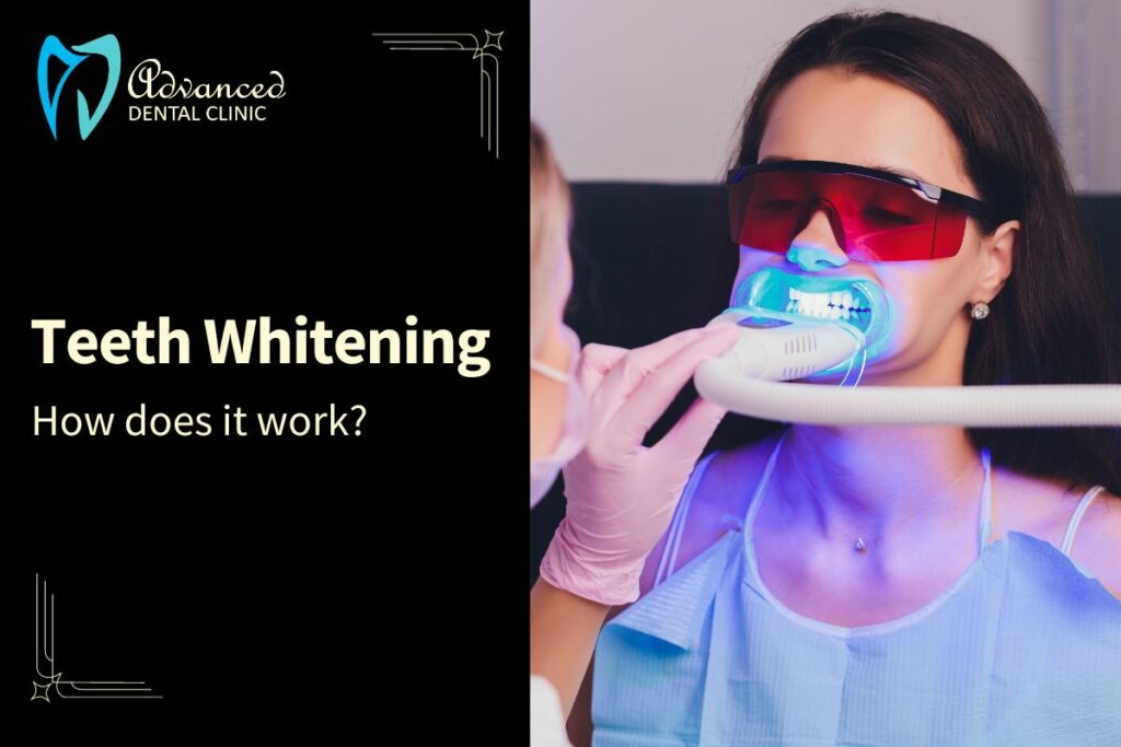 How teeth whitening is done