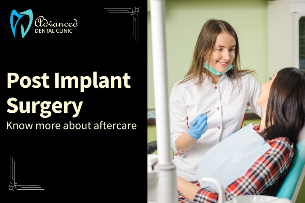 Post Dental Implant Surgery Guidelines