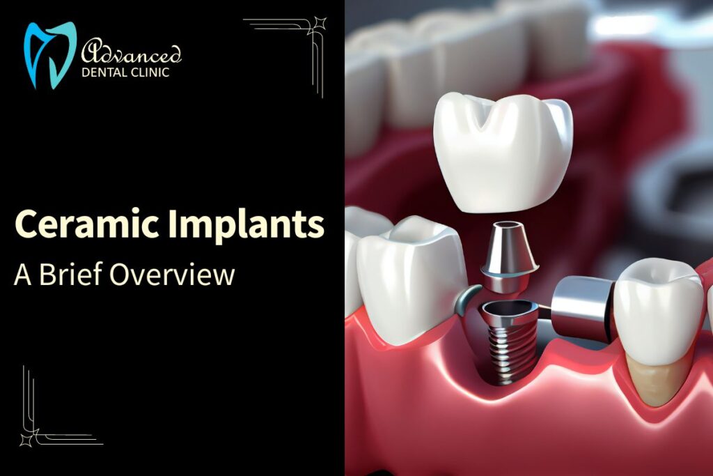What Are Ceramic Dental Implants